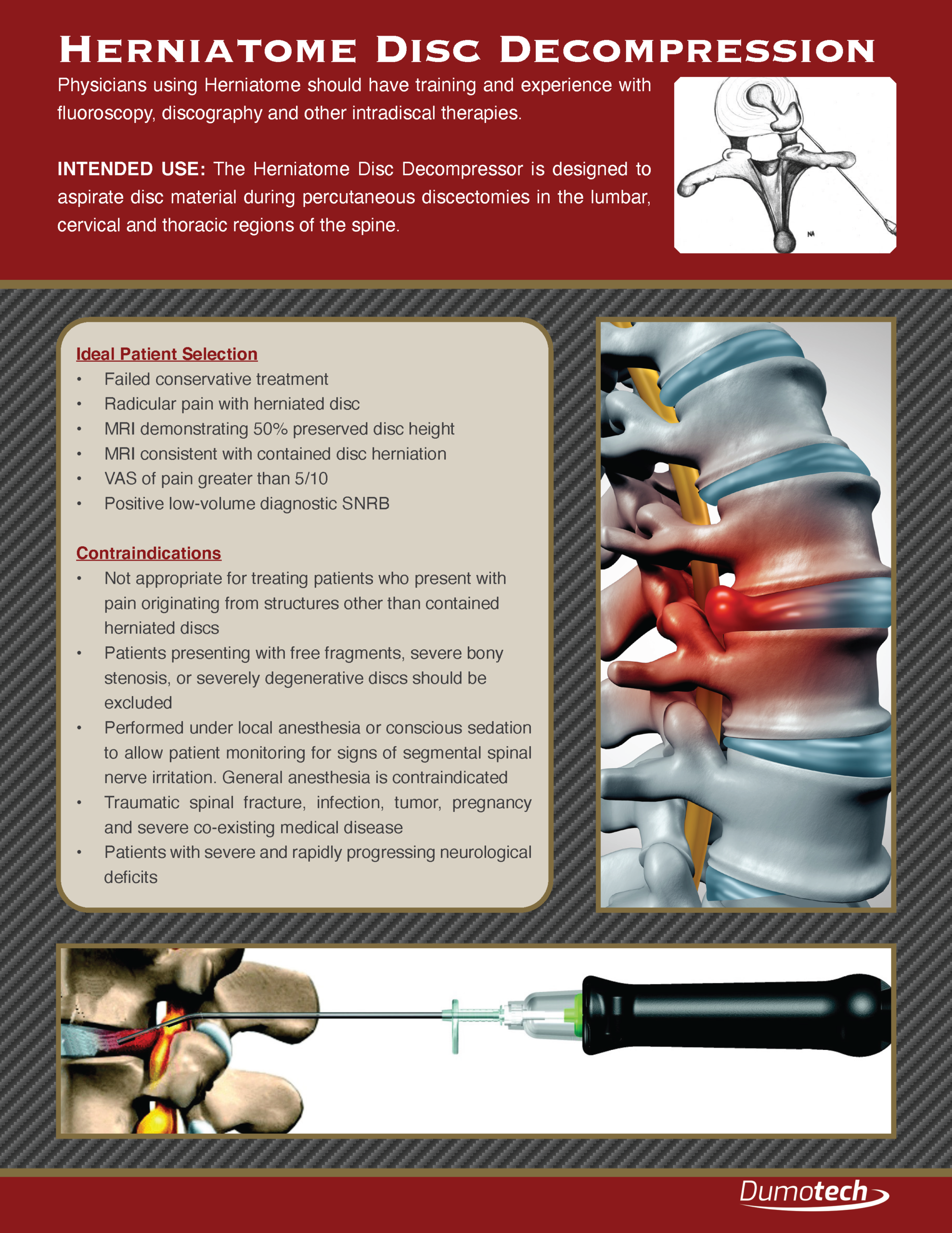 Operative Technique Guide_Page_2
