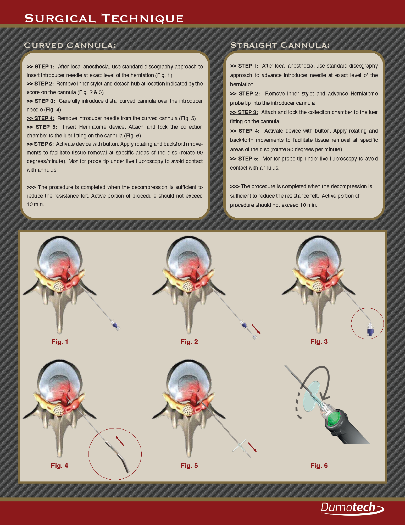 Operative Technique Guide_Page_5